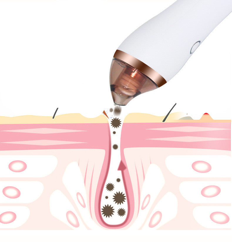 4-in-1 Body Gua Sha & Cupping Blackhead Remover – Facial Pore Deep Cleansing Skin Care Beauty Device