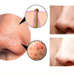 4-in-1 Body Gua Sha & Cupping Blackhead Remover – Facial Pore Deep Cleansing Skin Care Beauty Device