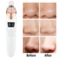 Professional Blackhead Remover Vacuum – Electric Pore Cleaner for Acne, Pimples & Deep Facial Cleansing